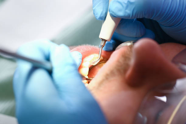 Reliable MI Emergency Dental Service Solutions